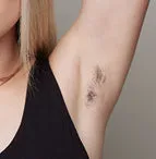 The effect of using ulike air 10 before underarm hair removal