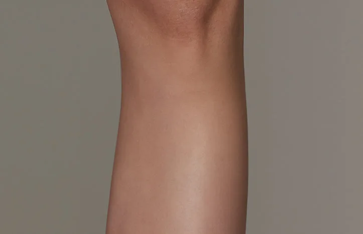 The effect of using ulike air 10 after leg hair removal